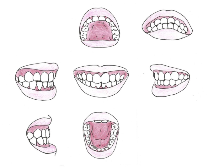 歯のイラスト、上顎、下顎、歯を閉じた状態での下、正面、右、左からの構図