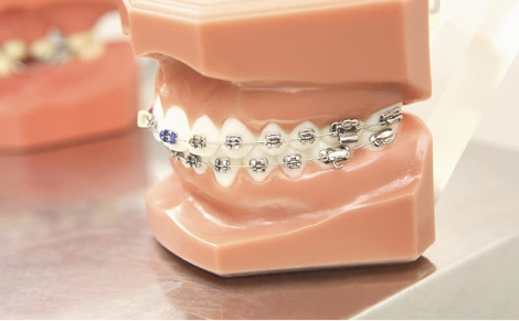 マルチブラケット装置