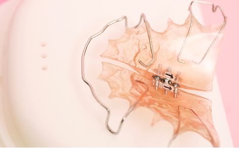 スクリュー付きプレート（拡大床）