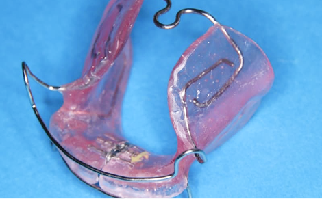 バイオネーター